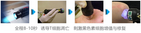 白癜风是什么原因引起的? 再不知道就晚了!