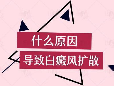 东方哪里治白癜风?为什么白癜风要对因医治