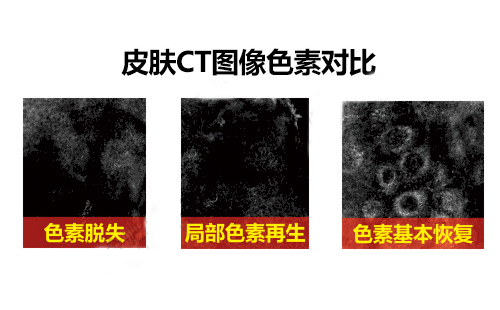 美国三维皮肤CT检测系