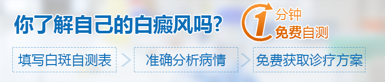 女性白癜风患者可以做美甲吗?