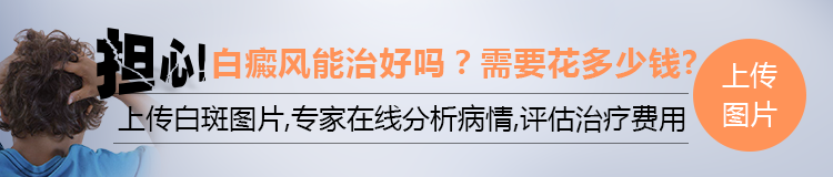 白癜风是什么原因引起的? 再不知道就晚了!