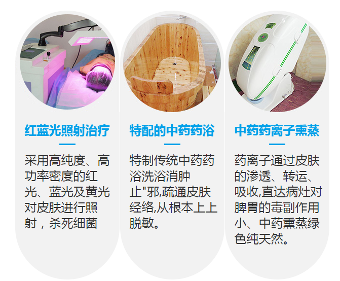 诊疗荨麻疹需要多少钱