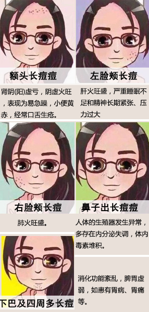 不同部位长痘痘原因,该怎么诊疗?