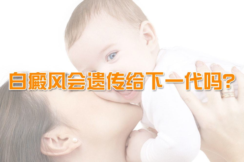 海口白癜风遗传怎么办