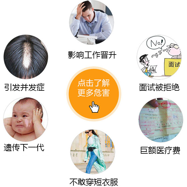 白癜风医院海口哪家好 男性白癜风如何护理