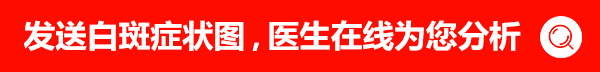治疗青少年白癜风有哪些误区