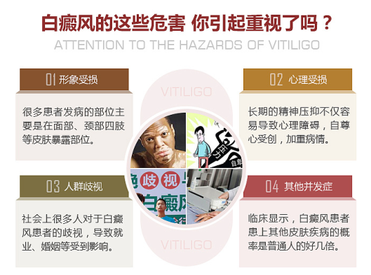 白癜风刚病发的时候会有哪些症状呢?