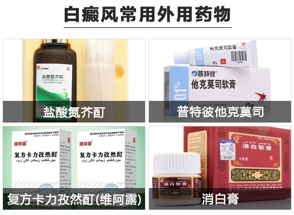 患白癜风用外用药过敏怎么办