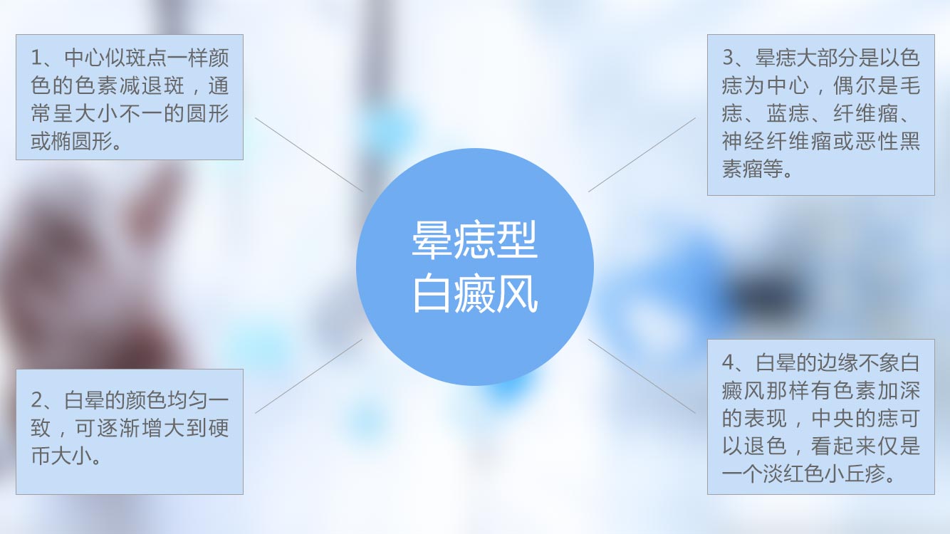 儋州晕痣不发展用治疗吗