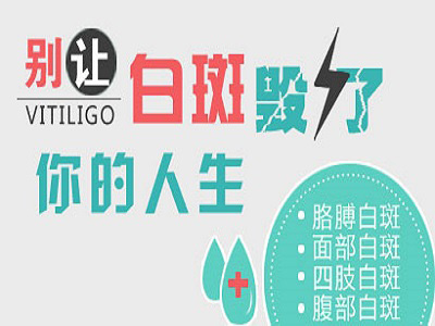 海口白癜风医院 初期白癜风只吃药抹药能好吗