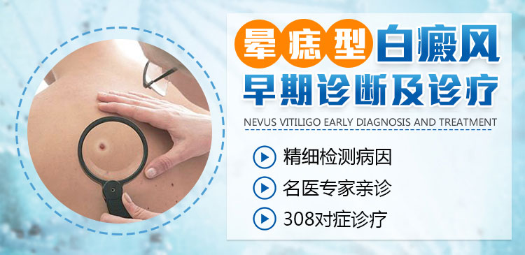 晕痣型白癜风要怎么治?需要多长时间