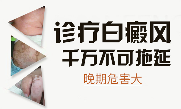 夏天到了白癜风医治需要留意什么