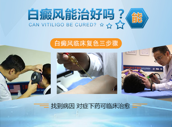 海口白癜风医院白癜风患者可以用花露水吗