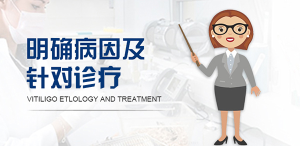 白癜风乱用药物的误区和危害你了解吗