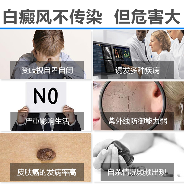 泛发性白斑会传染吗?