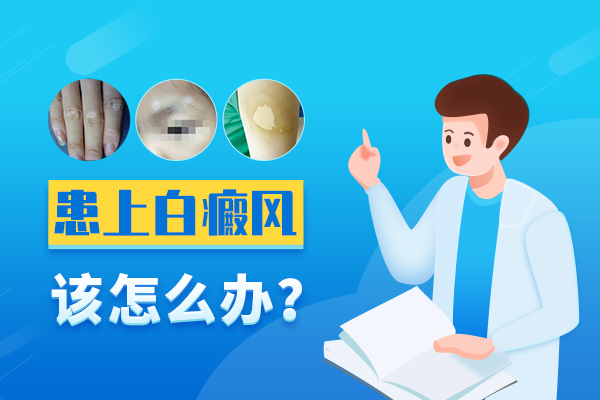 白癜风加重的原因是什么?