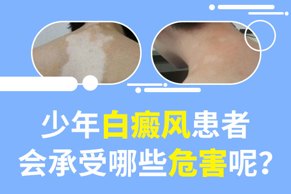 白癜风对孩子的影响?