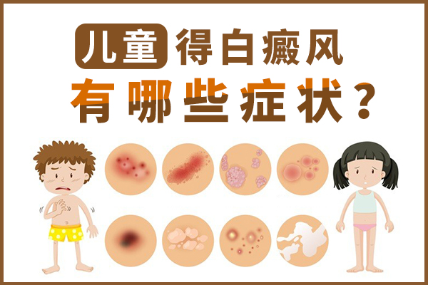 儿童早期白癜风的症状是什么?